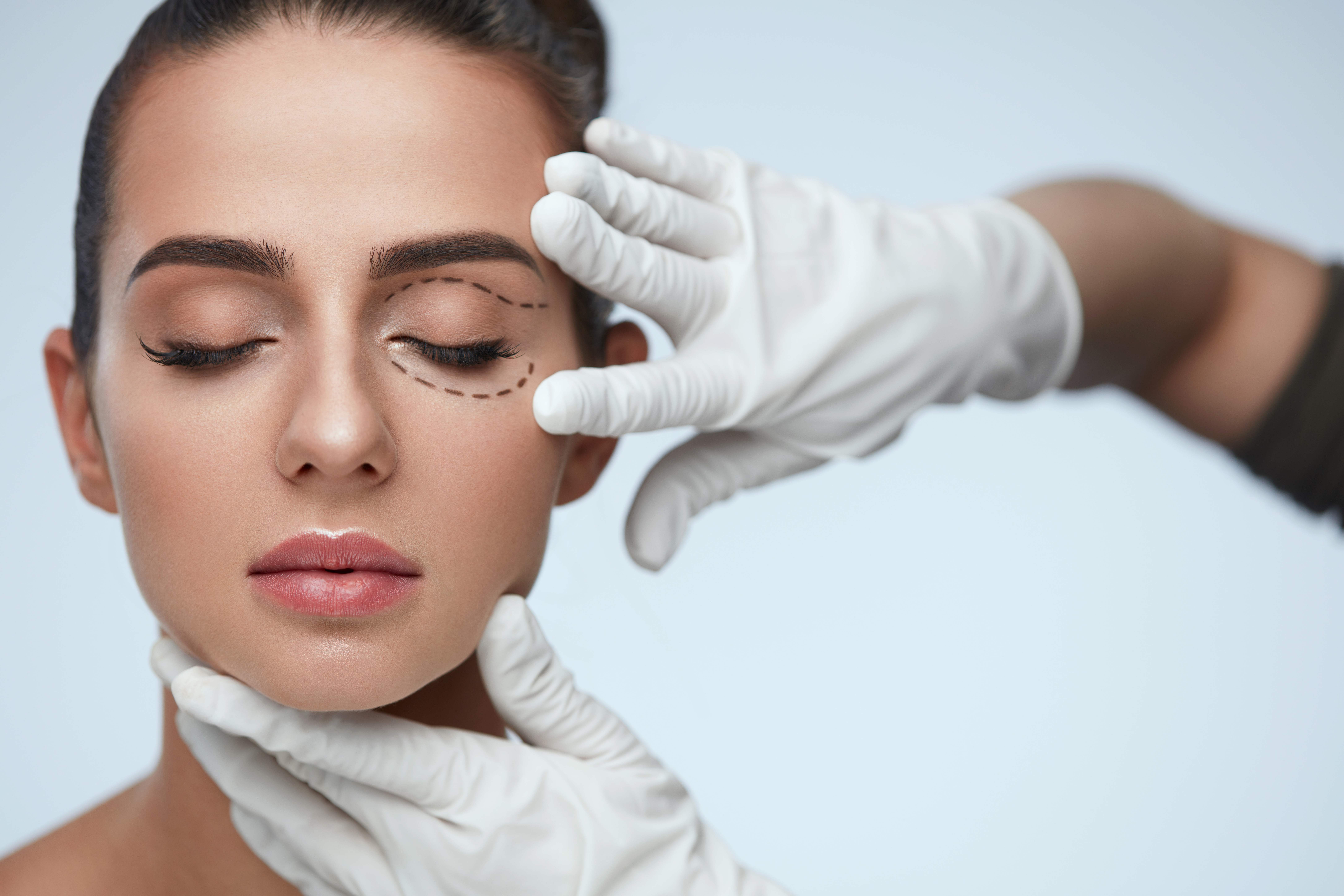 FAQS about eyelid surgery