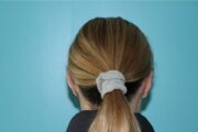 Ear Reshaping - Otoplasty