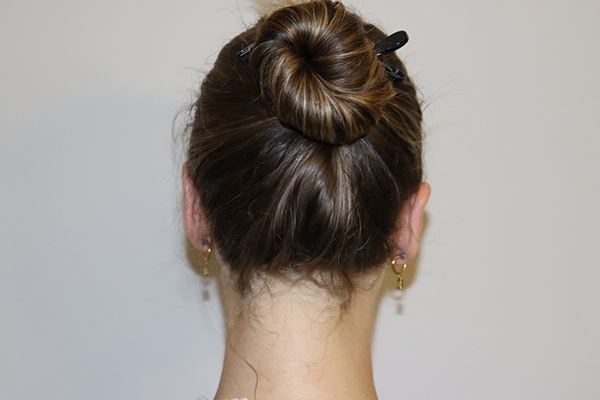 Ear Reshaping - Otoplasty
